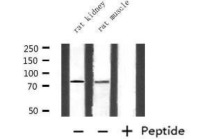 Western blot analysis of extracts from rat kidney and rat muscle, using CEACAM5 Antibody. (CEACAM5 Antikörper  (Internal Region))