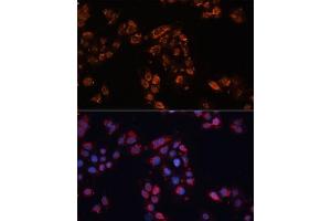 Immunofluorescence analysis of HeLa cells using  antibody (ABIN6129850, ABIN6136348, ABIN6136349 and ABIN6224537) at dilution of 1:100. (ABCB11 Antikörper  (AA 600-750))