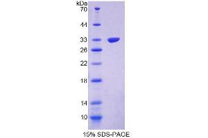 SDS-PAGE analysis of Mouse PPP1R15A Protein. (Protein phosphatase 1 (Regulatory Subunit 15A) Protein)