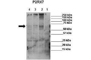 WB Suggested Anti-P2RX7 Antibody  Positive Control: Lane 1: 50ug mock transfected HEK-293Lane 2: 50ug hP2X7 transfected HEK-293Lane 3: 50ug mP2X7 transfected HEK-293Lane 4: 50ug rP2X7 transfected HEK-293 Primary Antibody Dilution :  1:625 Secondary Antibody : Anti-rabbit-HRP Secondry Antibody Dilution :  1:1000 Submitted by: Ronald Sluyter, School of Biological Sciences, University of Wollongong (P2RX7 Antikörper  (Middle Region))