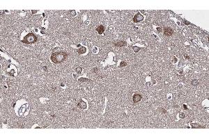 ABIN6277226 at 1/100 staining Human brain cancer tissue by IHC-P. (RIPK2 Antikörper  (N-Term))
