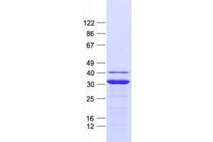 Validation with Western Blot (NADK2 Protein (His tag))