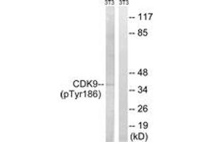 Western blot analysis of extracts from NIH-3T3 cells treated with Forskolin 40nM 30', using CDK9 (Phospho-Thr186) Antibody. (CDK9 Antikörper  (pThr186))
