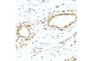 Immunohistochemistry (IHC) image for anti-X-Ray Repair Complementing Defective Repair in Chinese Hamster Cells 4 (XRCC4) (AA 1-336) antibody (ABIN3022382)