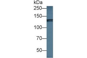 Western blot analysis of Human HeLa cell lysate, using Mouse NIN Antibody (1 µg/ml) and HRP-conjugated Goat Anti-Rabbit antibody ( (Ninein Antikörper  (AA 1-153))