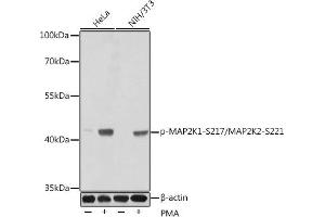 Western blot analysis of extracts of various cell lines, using Phospho-MK1-S217/MK2-S221 antibody (ABIN3019811, ABIN3019812, ABIN3019813, ABIN1681751 and ABIN1681752) at dilution. (MEK1 Antikörper  (pSer221, Ser217, Ser221))
