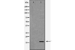 Western blot analysis of HEK293 cell lysate, using CST8 Antibody. (CST8 Antikörper  (Internal Region))