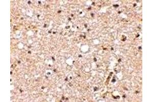 Immunohistochemistry (IHC) image for anti-Glutamate Receptor, Ionotropic, Kainate 1 (GRIK1) (Middle Region) antibody (ABIN1030944) (GRIK1 Antikörper  (Middle Region))
