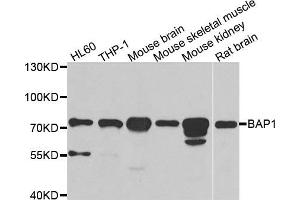 Western blot analysis of extracts of various cell lines, using BAP1 antibody. (BAP1 Antikörper)