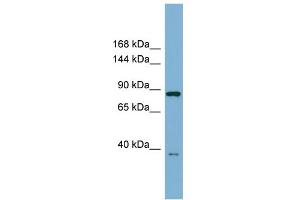 WB Suggested Anti-FAM62C Antibody Titration:  0. (ESYT3 Antikörper  (Middle Region))