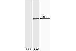 Western blot analysis of PARP (cleavage site-specific). (PARP1 Antikörper  (Asp214, cleaved))