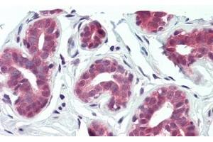 Immunohistochemistry (IHC) image for anti-Integrin beta-6 (ITGB6) (AA 131-619) antibody (ABIN7442951)