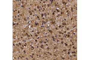 IHC analysis of ADRM1/ARM-1 using anti-ADRM1/ARM-1 antibody (ABIN7600108).