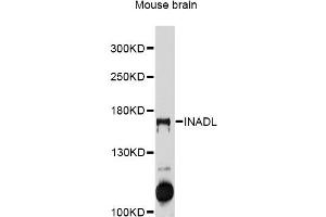 Western blot analysis of extracts of mouse brain, using INADL antibody (ABIN5997988) at 1/1000 dilution. (PATJ Antikörper)