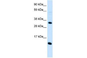 WB Suggested Anti-CCL18  Antibody Titration: 0. (CCL18 Antikörper  (Middle Region))