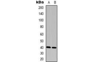 Western blot analysis of FAM203A expression in Hela (A), Colo320 (B) whole cell lysates. (FAM203B Antikörper)