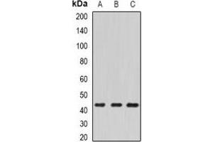 Western blot analysis of ECSIT expression in HepG2 (A), mouse kidney (B), mouse heart (C) whole cell lysates. (ECSIT Antikörper)