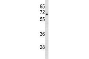 HAS3 antibody western blot analysis in A549 lysate. (HAS3 Antikörper  (AA 137-164))