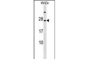 TGIF2LY Antibody (N-term) (ABIN1538862 and ABIN2849859) western blot analysis in WiDr cell line lysates (35 μg/lane).