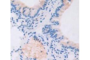 Figure. (TBX3 Antikörper  (AA 107-220))