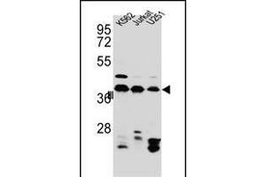 HNRNPC Antibody (C-term) (ABIN654685 and ABIN2844378) western blot analysis in Jurkat,K562, cell line lysates (35 μg/lane). (HNRNPC Antikörper  (C-Term))