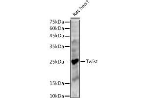 Western blot analysis of extracts of Rat heart, using Twist antibody (ABIN6133951, ABIN6149713, ABIN6149716 and ABIN6220170) at 1:500 dilution. (TWIST1 Antikörper  (AA 1-100))