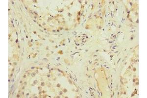 Immunohistochemistry of paraffin-embedded human testis tissue using ABIN7176632 at dilution of 1:100