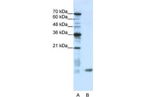 Western Blotting (WB) image for anti-SRA Stem-Loop Interacting RNA Binding Protein (SLIRP) antibody (ABIN2462309) (SLIRP Antikörper)