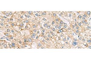 Immunohistochemistry (Paraffin-embedded Sections) (IHC (p)) image for anti-Heme Oxygenase (Decycling) 1 (HMOX1) antibody (ABIN7003767)