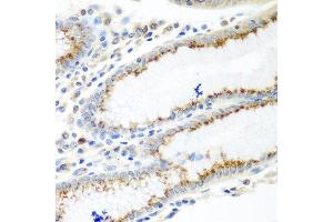 Immunohistochemistry of paraffin-embedded human stomach using UBIAD1 antibody at dilution of 1:100 (40x lens). (UBIAD1 Antikörper)