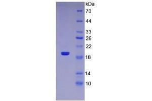 Image no. 1 for Tumor Necrosis Factor (Ligand) Superfamily, Member 10 (TNFSF10) (AA 114-281) (Active) protein (His tag) (ABIN6239814)