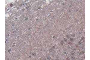 Immunohistochemistry (IHC) image for anti-Pyruvate Dehyrogenase Phosphatase Catalytic Subunit 2 (PDP2) (AA 1-187) antibody (ABIN7445150)