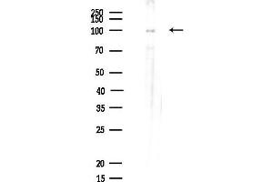 anti-Aminoadipate Semialdehyde Synthase (AASS) (C-Term) antibody