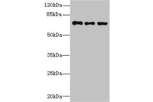 Western blot All lanes: ZNF614 antibody at 6 μg/mL Lane 1: Jurkat whole cell lysate Lane 2: HepG2 whole cell lysate Lane 3: A549 whole cell lysate Secondary Goat polyclonal to rabbit IgG at 1/10000 dilution Predicted band size: 68, 23 kDa Observed band size: 68 kDa (ZNF614 Antikörper  (AA 1-198))