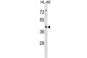 Western Blotting (WB) image for anti-Regulator of G-Protein Signaling 11 (RGS11) antibody (ABIN2999155) (RGS11 Antikörper)