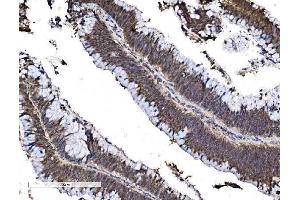 IHC analysis of FOXA2 using anti-FOXA2 antibody (ABIN7600003).