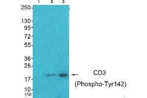 Western blot analysis of extracts from JK cells (Lane 2) and K562 cells (Lane 3), using CD3 zeta (Phospho-Tyr142) antibody.
