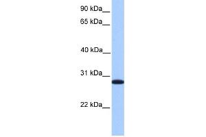 WB Suggested Anti-CDKN3 Antibody Titration: 0. (CDKN3 Antikörper  (C-Term))