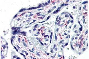 Human Placenta (formalin-fixed, paraffin-embedded) stained with IL1R1 antibody ABIN364253 at 10 ug/ml followed by biotinylated anti-mouse IgG secondary antibody ABIN481714, alkaline phosphatase-streptavidin and chromogen. (IL1R1 Antikörper  (Extracellular Domain))