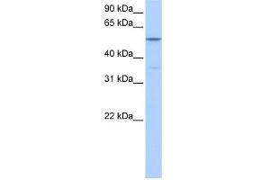 CHKA antibody used at 1 ug/ml to detect target protein. (Choline Kinase alpha Antikörper  (Middle Region))