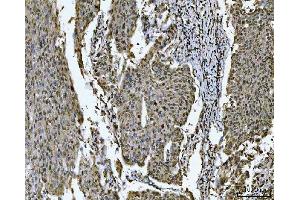 IHC analysis of SNRPN using anti-SNRPN antibody (ABIN3043934). (SNRPN Antikörper  (N-Term))