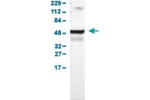Western Blot analysis of human cell line RT-4.