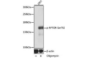Western blot analysis of extracts of 293T cells using Phospho-RPTOR(Ser792) Polyclonal Antibody at dilution of 1:1000. (Raptor Antikörper  (pSer792))
