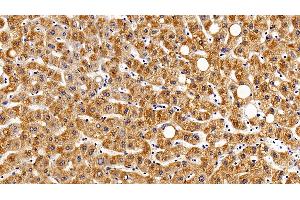 Detection of gp130 in Human Liver Tissue using Polyclonal Antibody to Glycoprotein 130 (gp130) (CD130/gp130 Antikörper  (AA 392-566))