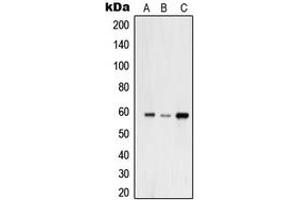 Western blot analysis of USP30 expression in A549 (A), HeLa (B), THP1 (C) whole cell lysates.