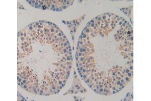 IHC-P analysis of Kidney tissue, with DAB staining.