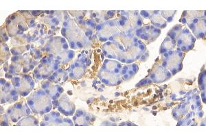 Immunohistochemistry (IHC) image for anti-Hemoglobin antibody (ABIN7429571)