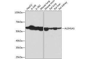 Western blot analysis of extracts of various cell lines, using  Rabbit mAb (ABIN7265531) at 1:1000 dilution. (ALDH1A1 Antikörper)