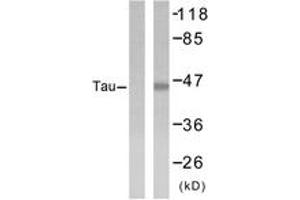 Western blot analysis of extracts from 293 cells, treated with UV, using Tau (Ab-404) Antibody. (tau Antikörper  (AA 691-740))