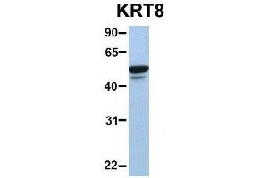 Western Blotting (WB) image for anti-Keratin 8 (KRT8) (Middle Region) antibody (ABIN2777113)